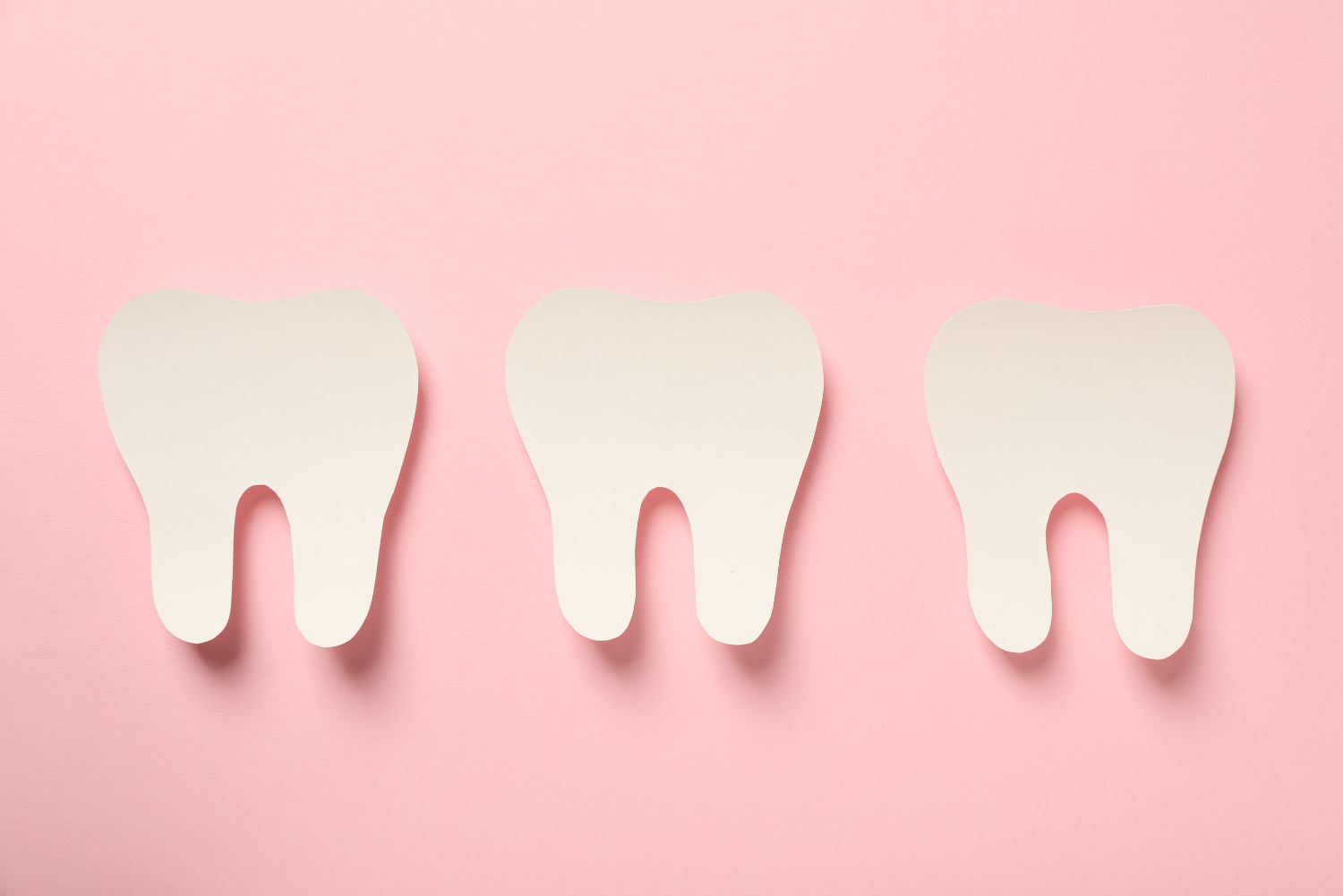 インプラント治療