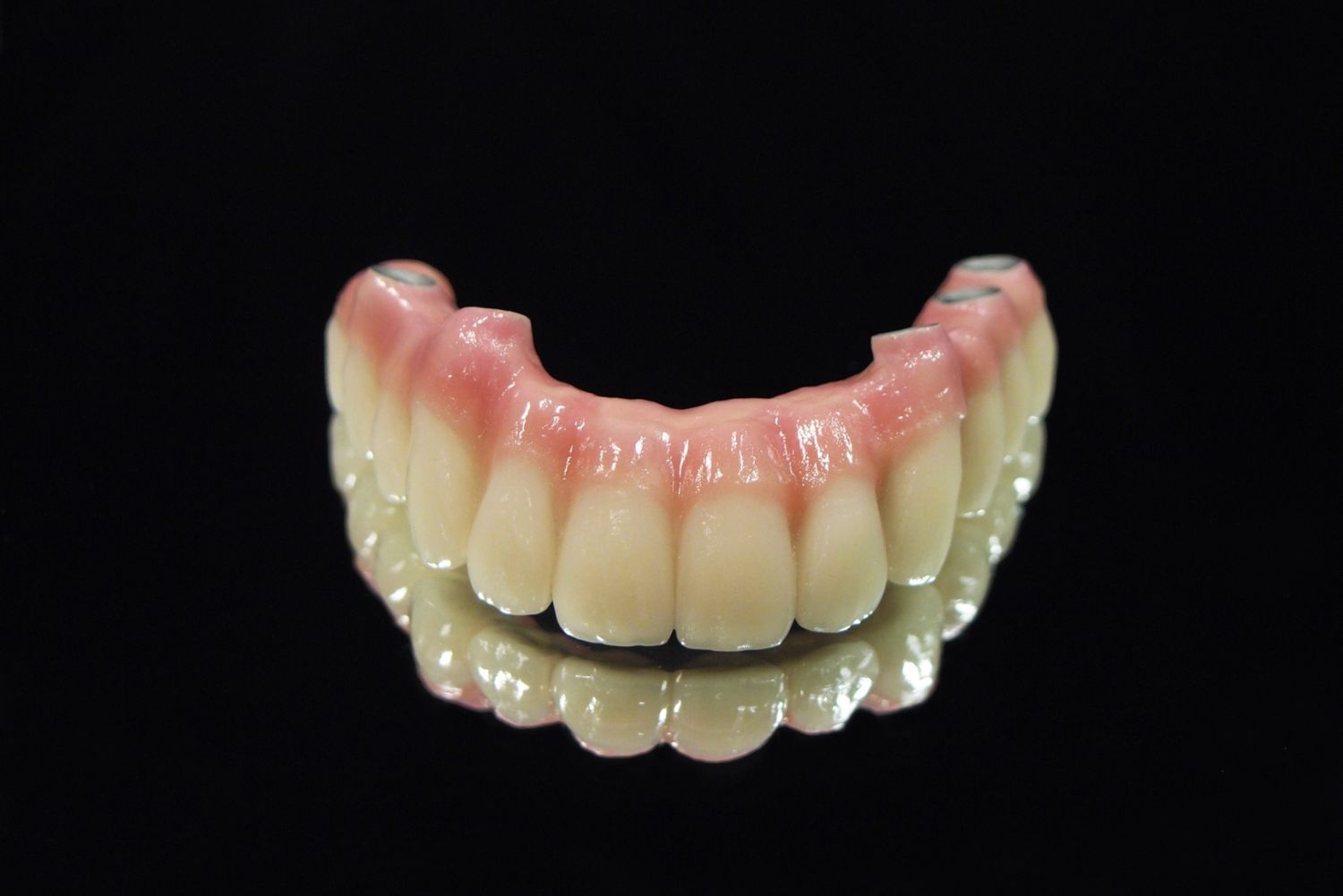 インプラント治療