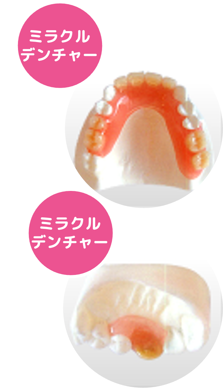 ミラクルデンチャー