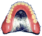 Co-Cr床コバルトクロム